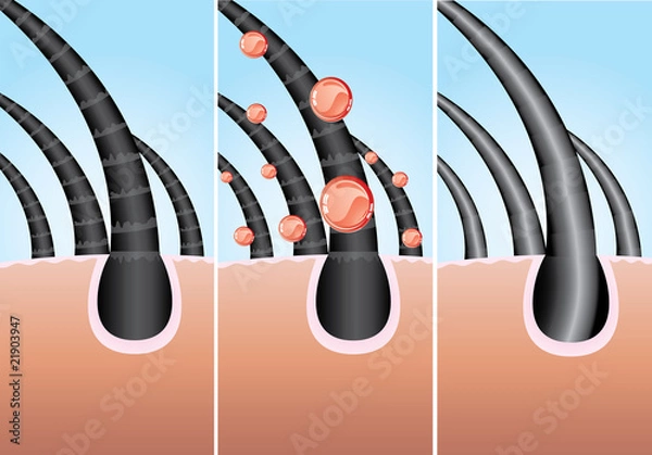Fototapeta Illustration of three phase of hair cure, vector