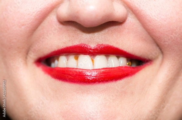 Obraz red lips and dirty teeth macro woman