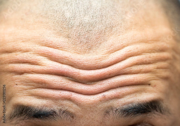Obraz close-up on wrinkled forehead