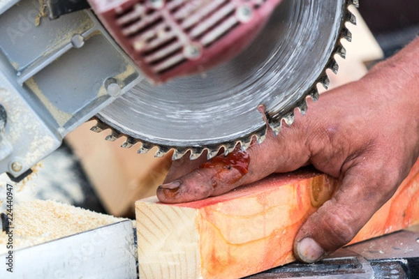 Fototapeta Injury when working with a saw. Place for your text.