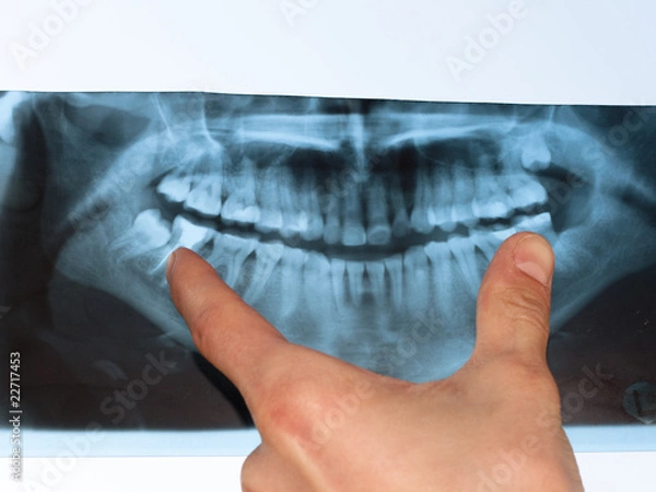 Obraz Dental X-Ray panoramic