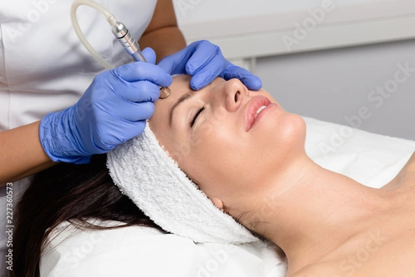 Obraz Piękna kobieta coraz zabieg mikrodermabrazji twarzy peeling w luksusowej klinice kosmetycznej spa. Złuszczanie, odmładzanie i nawilżanie. Koncepcja kosmetologii.