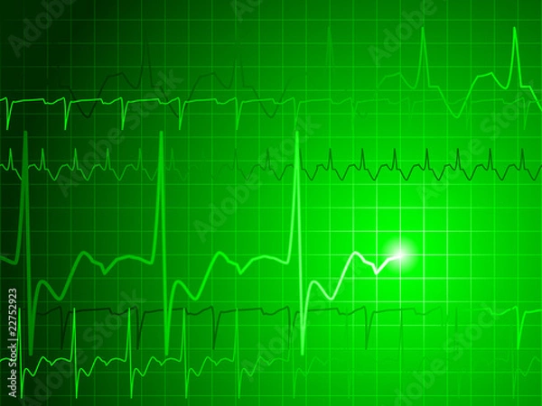 Fototapeta EKG background
