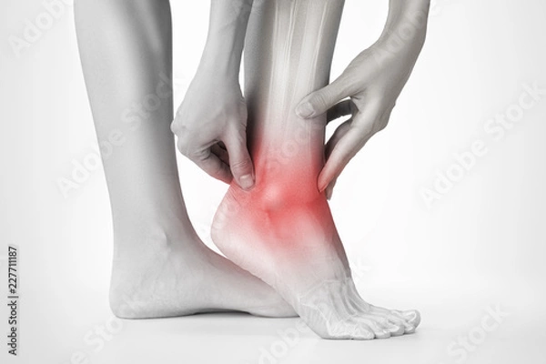 Obraz Ankle pain, foot painful point.