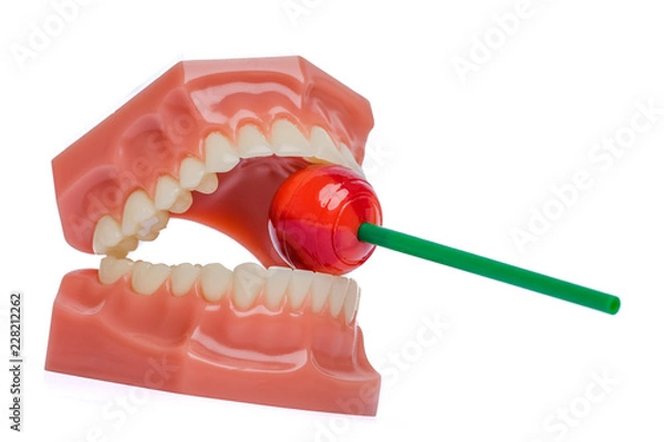 Obraz Orthodontic Teeth Model with red lolipop