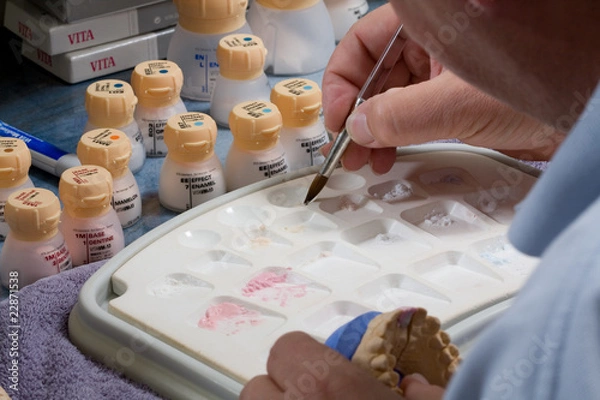 Obraz Zahnkrone anfertigen 006