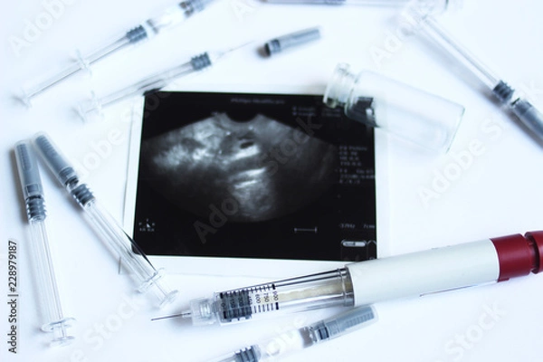 Fototapeta Assisted reproductive technology injection pen and small syringes with ovarian ultrasound in the middle. IVF and IUI Treatment Drugs. Medication  for infertility treatment
