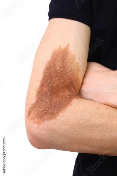 Obraz Problems of the skin