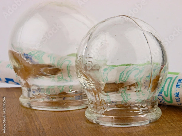 Obraz Traditional Chinese Cupping