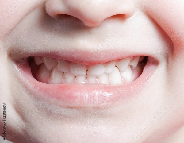 Obraz Child teeth