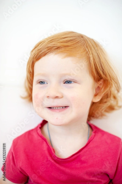 Fototapeta Allergies, atopic dermatitis on the face of a baby