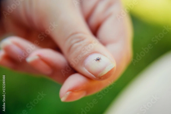 Obraz Tick crawling on finger. The concept of danger of tick bite.