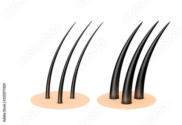 Fototapeta Human scalp. 