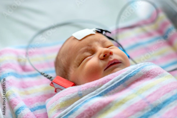 Obraz hearing test of a sleeping newborn at hospital
