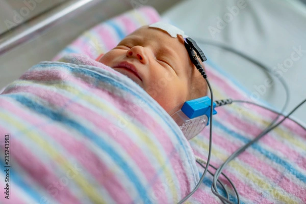 Obraz hearing test of a sleeping newborn at hospital