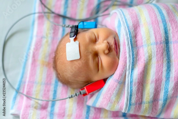 Obraz hearing test of a sleeping newborn at hospital