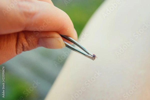 Obraz Tick crawling on finger. The concept of danger of tick bite.