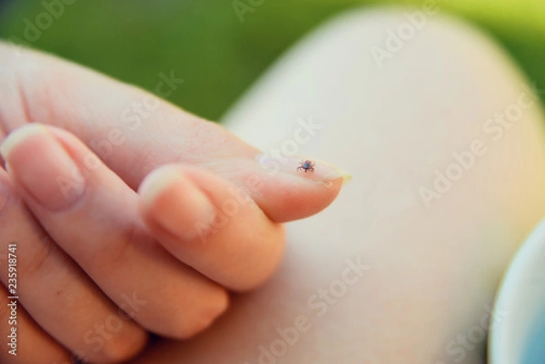 Obraz Tick crawling on finger. The concept of danger of tick bite.