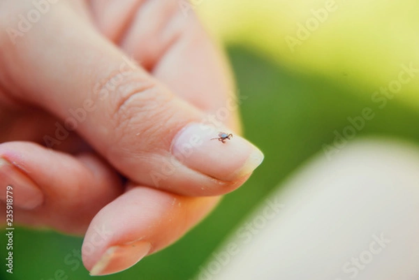 Obraz Tick crawling on finger. The concept of danger of tick bite.