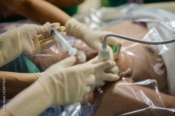 Obraz Procedure of local anesthesia for surgery to treatment patient in operating room.