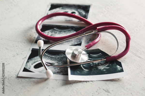 Fototapeta In the pictures of the ultrasound 4 weeks of pregnancy and 20 weeks is a phonendoscope. The concept of the study of pregnancy. Observation Selective focus.