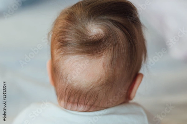 Fototapeta Bald spot at the back of baby's head 