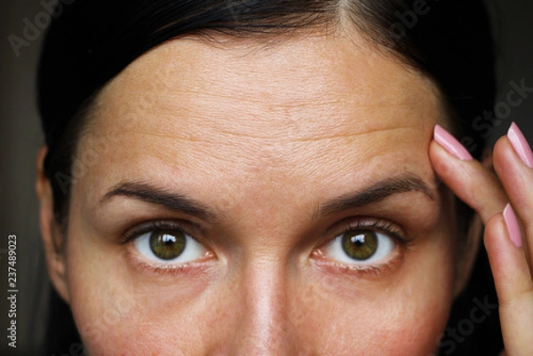 Obraz deep forehead wrinkles