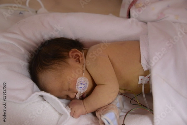 Obraz NICU BABY