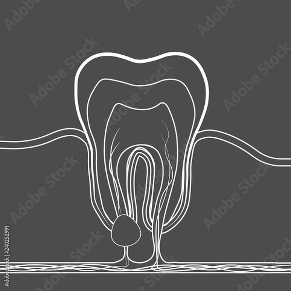Fototapeta dental disease linear icon. Medical illustration of tooth root inflammation, tooth root cyst, pulpitis.