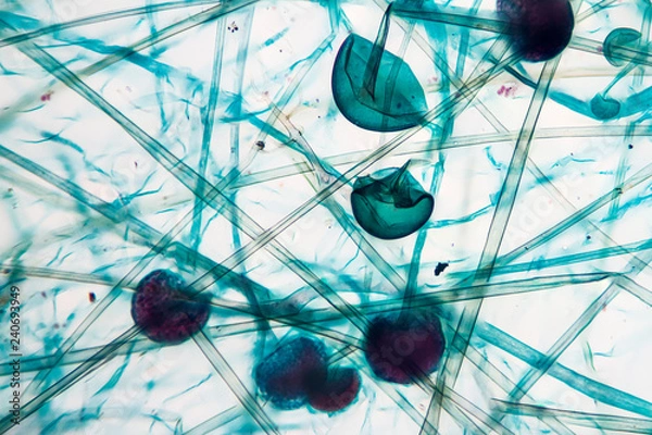 Fototapeta Rhizopus fungi viewed under the microscope, saprophytic and parasite fungi.
