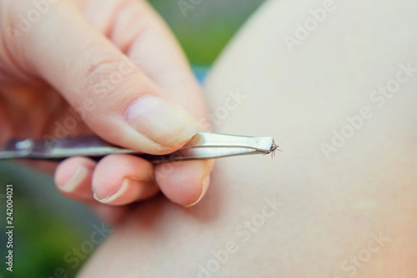 Fototapeta Tick crawling on finger. The concept of danger of tick bite.