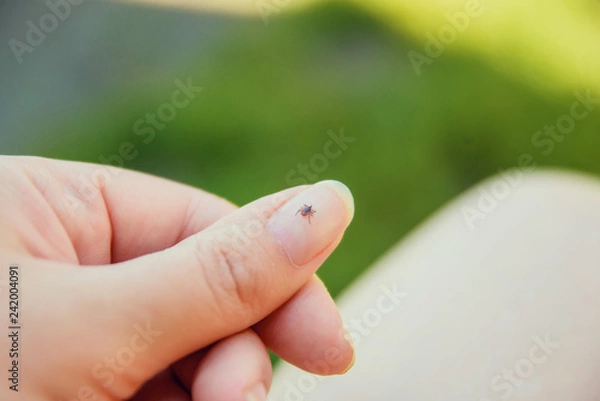 Obraz Tick crawling on finger. The concept of danger of tick bite.