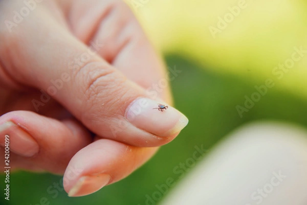 Obraz Tick crawling on finger. The concept of danger of tick bite.