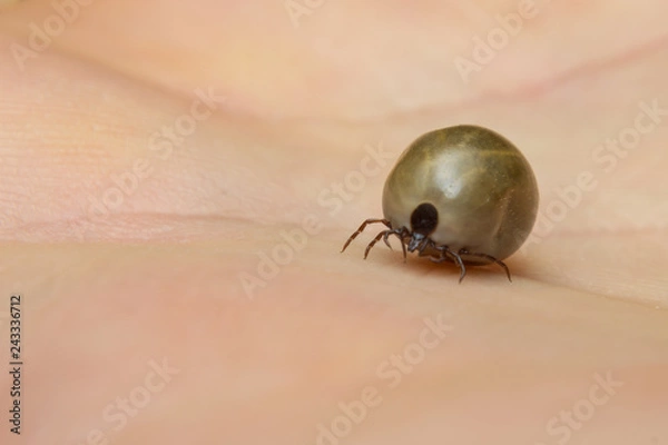 Fototapeta Fat tick on hand skin surface