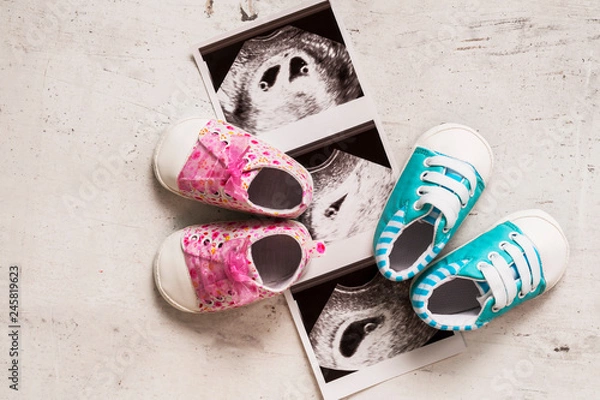 Fototapeta Blue and pink booties next to baby photos with ultrasound in 4th week of pregnancy. Waiting for twins. Son and daughter. Selective focus.