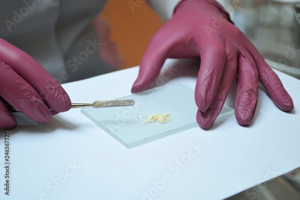 Fototapeta Close-up of a dentist in purple gloves prepares the material for filling the tooth canal. 