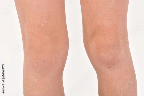 Fototapeta 子供の脚