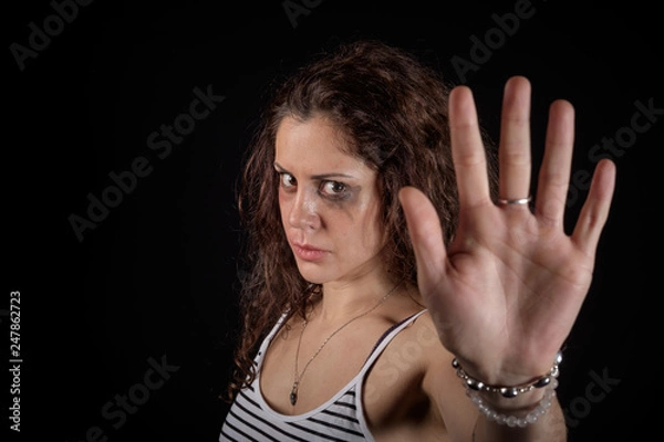 Obraz Stop violence message from a scared woman with bruises and wounds marks on her face after a case of gender violence in a young couple