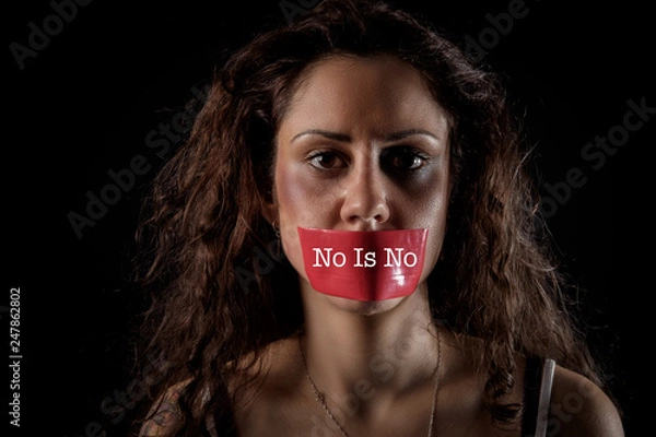 Obraz closeup portrait of a young woman with bruises and wounds marks on her face and her mouth is silenced with a red tape
