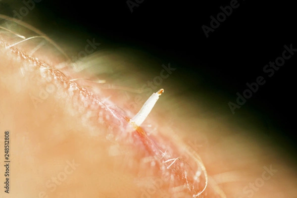 Fototapeta bot fly larvae inside flesh