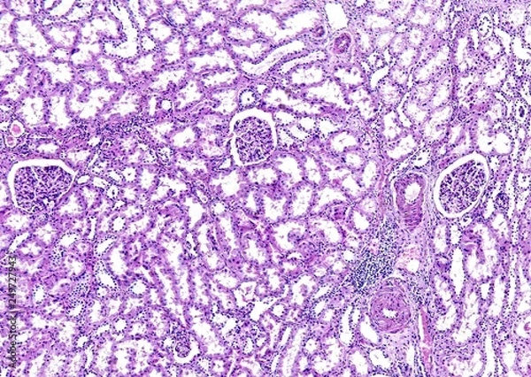 Fototapeta Histology of human tissue, show arteriolar hyaline degeneration of kidney as seen under the microscope, 10x zoom