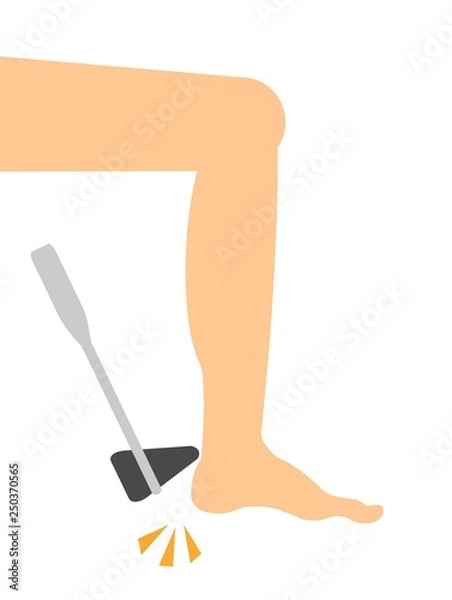 Fototapeta 脚気の検査