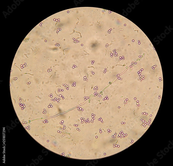 Fototapeta microscopic view of the fungi candida albicans in the native preparation