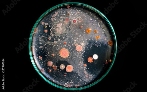 Obraz Top view soil microorganisms Nutrient agar in plate on black background.