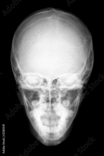 Fototapeta front face