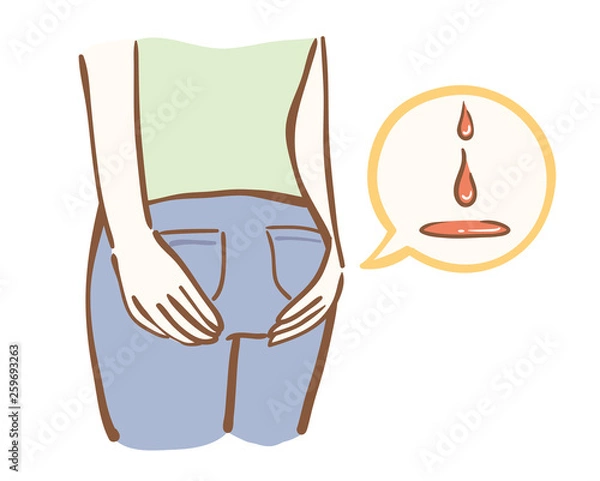 Obraz 生理漏れ　出血　女性