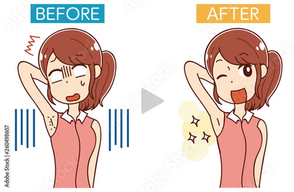 Obraz イラスト素材: エステ・女性のムダ毛処理・ビフォーアフター