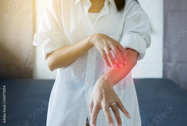 Obraz Woman with rash or papule and scratch arm from allergies,Health allergy skin care problem