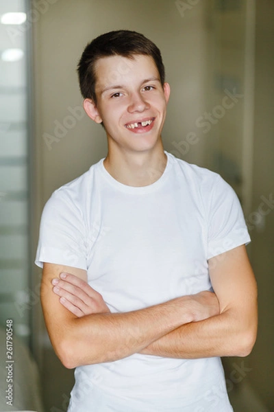 Fototapeta young man without front tooth