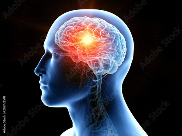 Obraz 3d rendered medically accurate illustration of human brain cancer